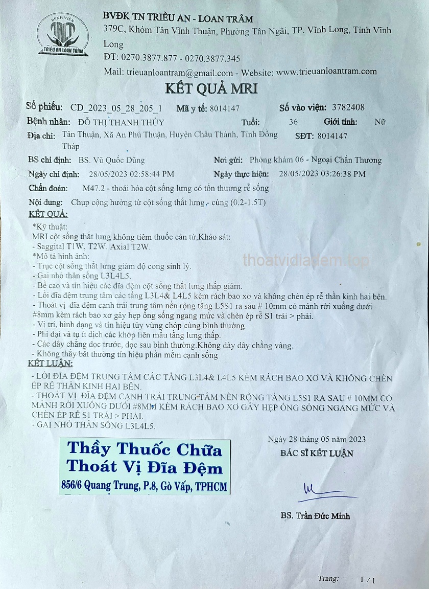 Chữa khỏi thoát vị đĩa đệm.